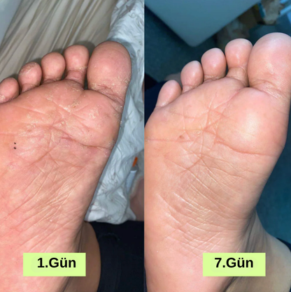 Mantar Giderici Sabun ve Özel Lif